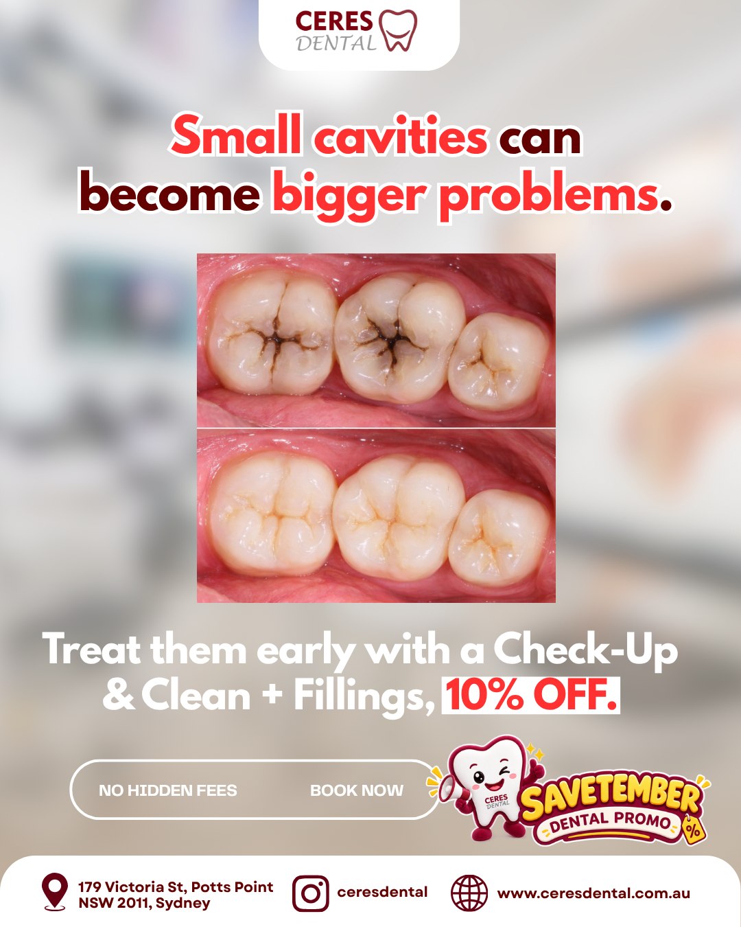 Check-up & Fillings Bundle